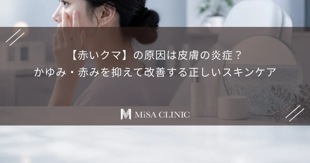 【赤いクマ】の原因は皮膚の炎症？かゆみ・赤みを抑えて改善する正しいスキンケア