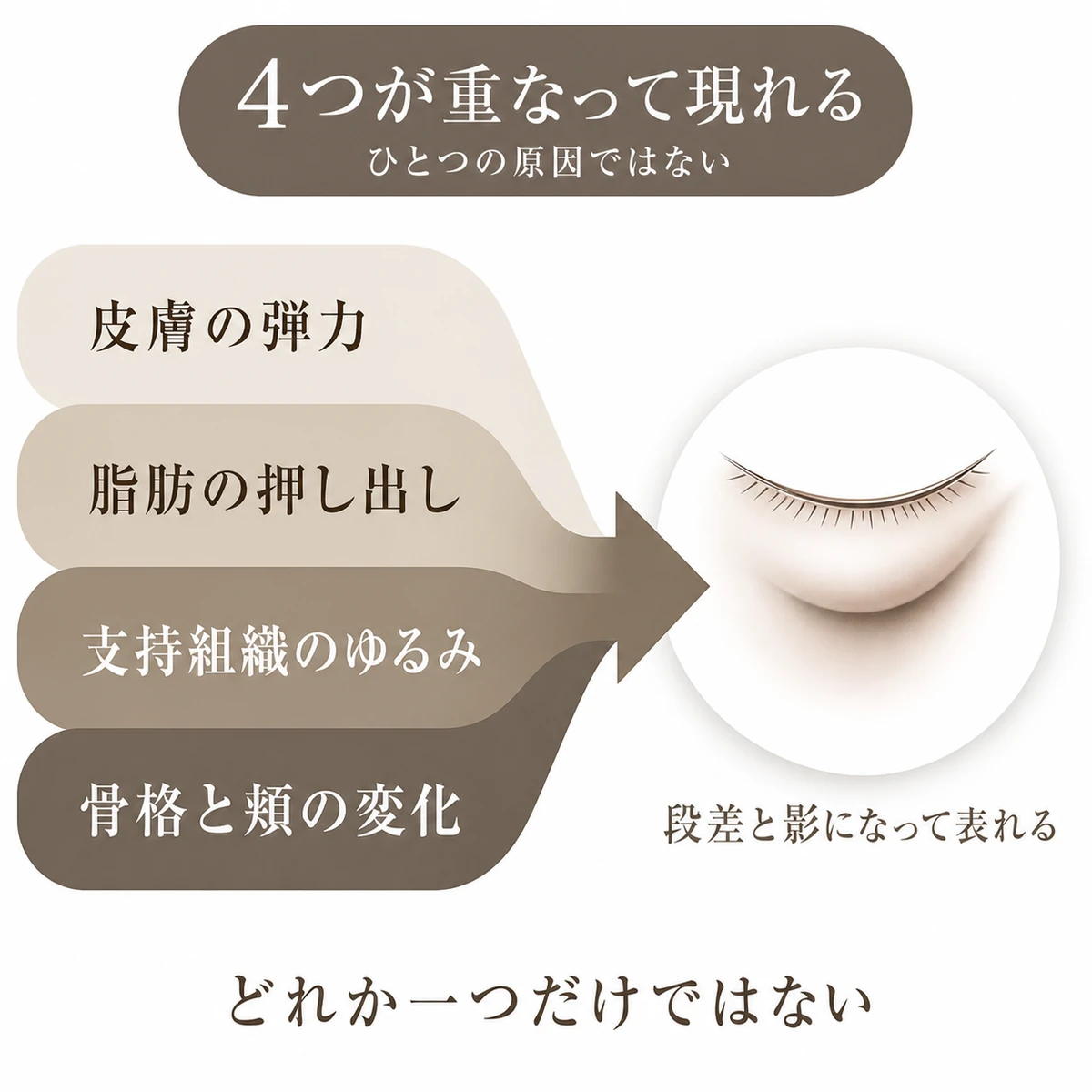 皮膚の弾力、脂肪、支持組織、骨格と頬の変化が重なり、目の下の段差と影につながる様子
