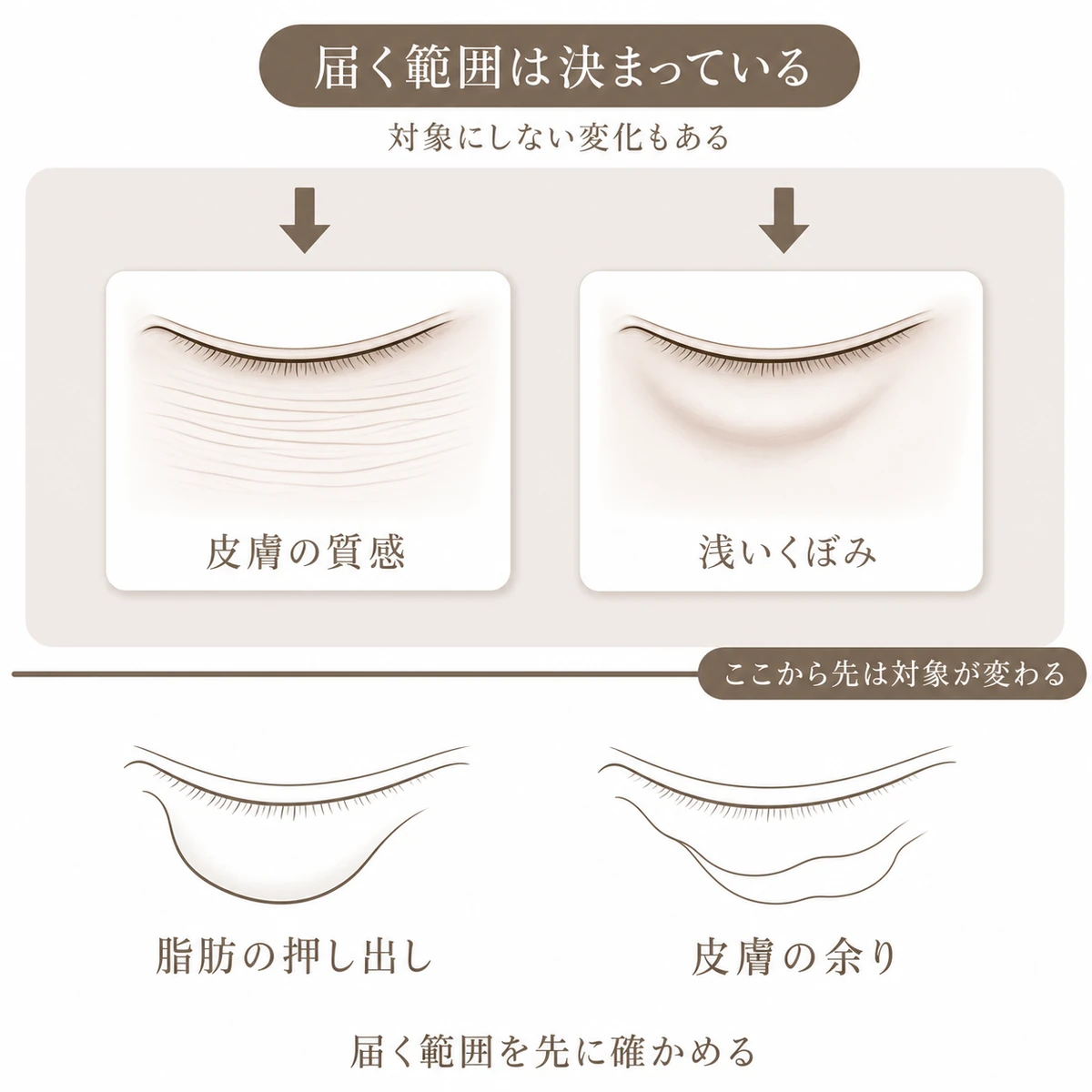 切らない治療が対象とする皮膚の質感や浅いくぼみと、対象の異なる脂肪の押し出しや皮膚の余りの区分