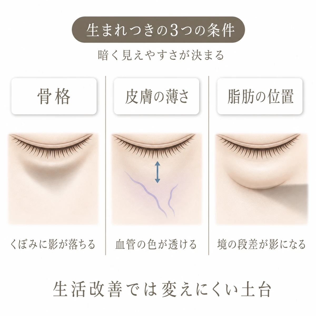 骨格のくぼみ、皮膚の薄さ、脂肪の位置が目の下の影や色に関わる様子を分けた図