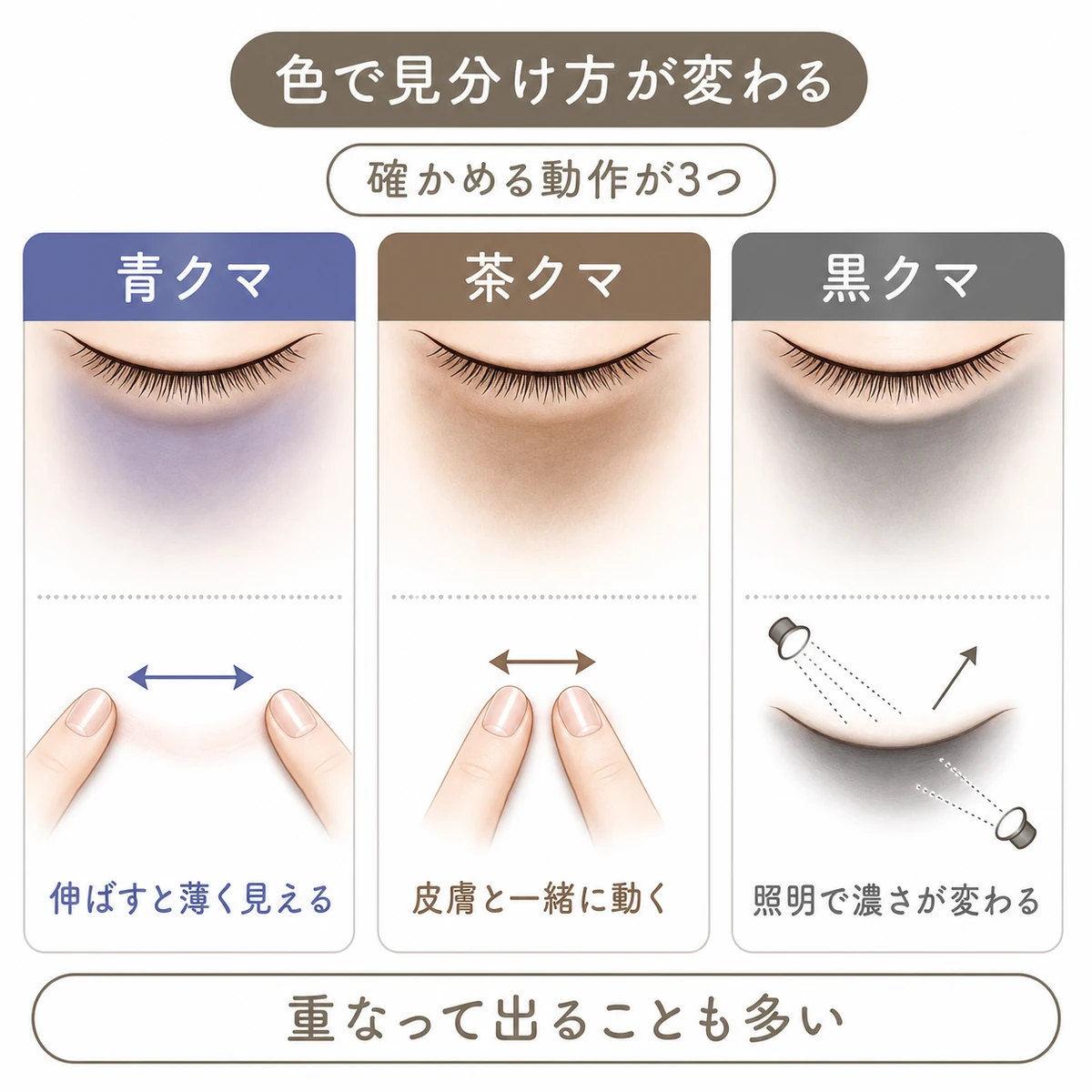 青クマ・茶クマ・黒クマの違いと、皮膚や照明による確かめ方を並べた分類図
