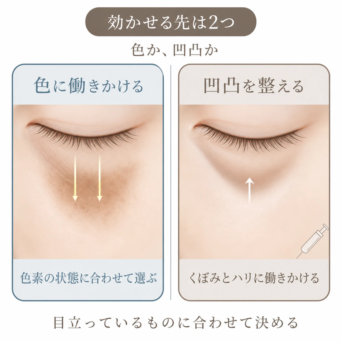 目の下の色と凹凸それぞれに働きかける治療の考え方を対比したイラスト