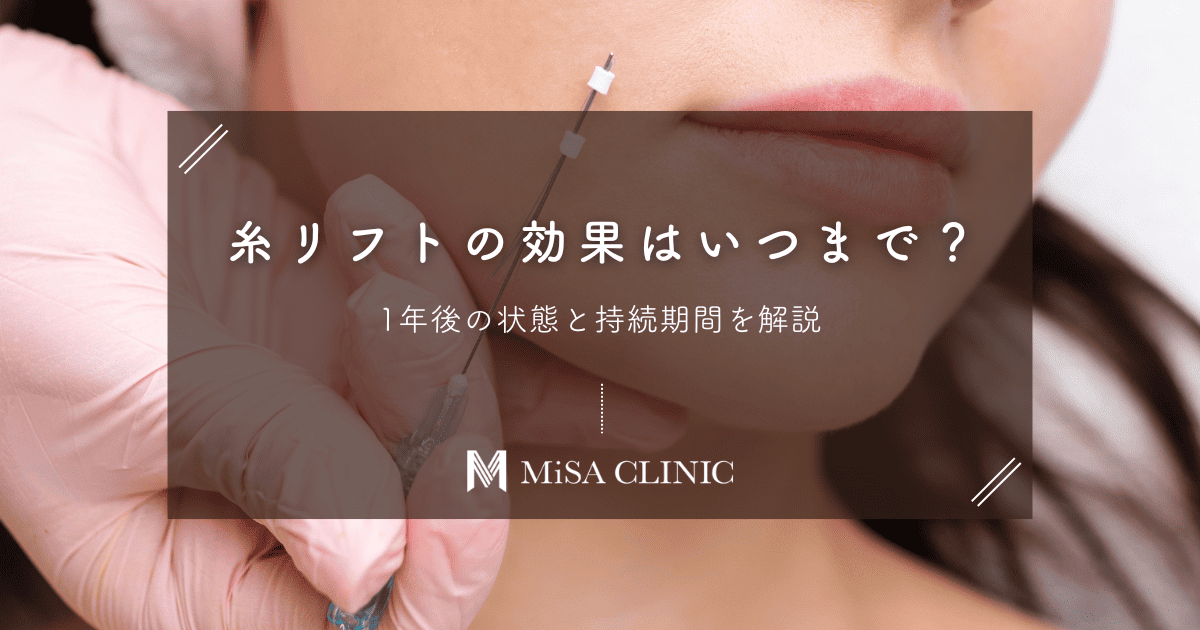糸リフトの効果はいつまで？1年後の状態と持続期間を解説