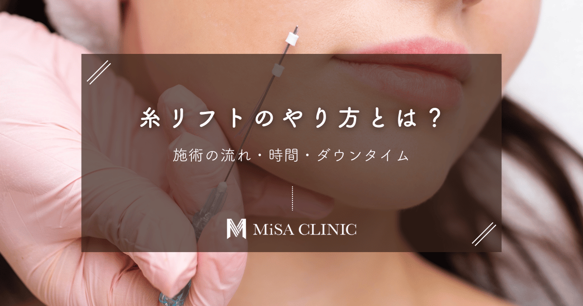 糸リフトのやり方とは？施術の流れ・時間・ダウンタイム