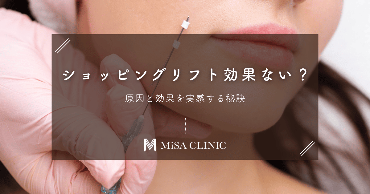 ショッピングリフト「効果ない」はホント?原因と効果を実感する秘訣