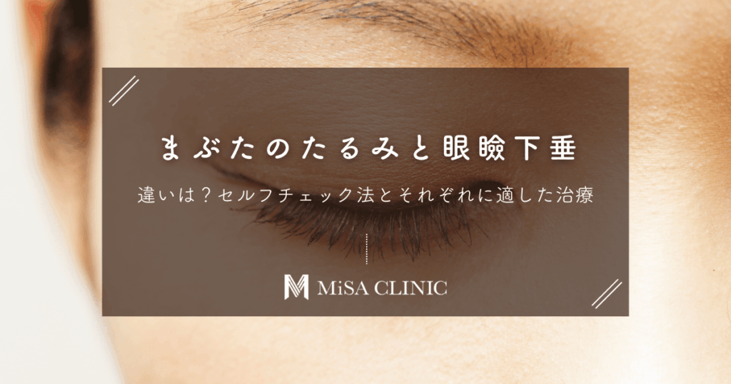 まぶたのたるみと眼瞼下垂の違いは？セルフチェック法とそれぞれに適した治療
