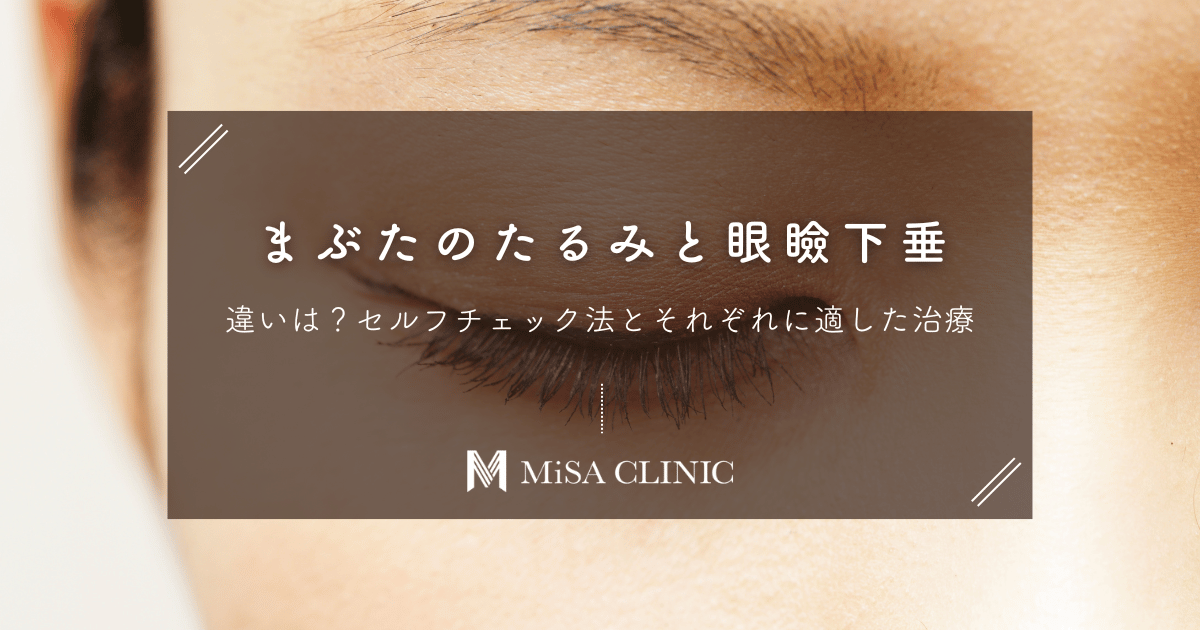 まぶたのたるみと眼瞼下垂の違いは？セルフチェック法とそれぞれに適した治療