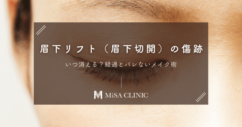 眉下リフト（眉下切開）の傷跡はいつ消える？経過とバレないメイク術