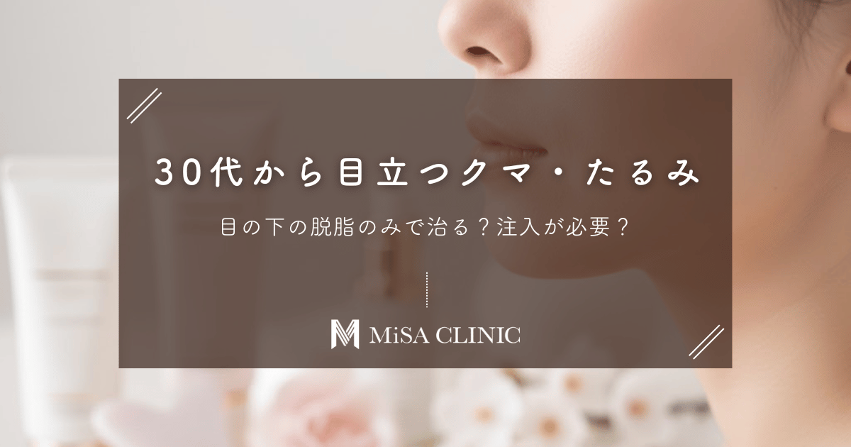 30代から目立つ「目の下のクマ・たるみ」｜脱脂のみで治る？注入が必要？