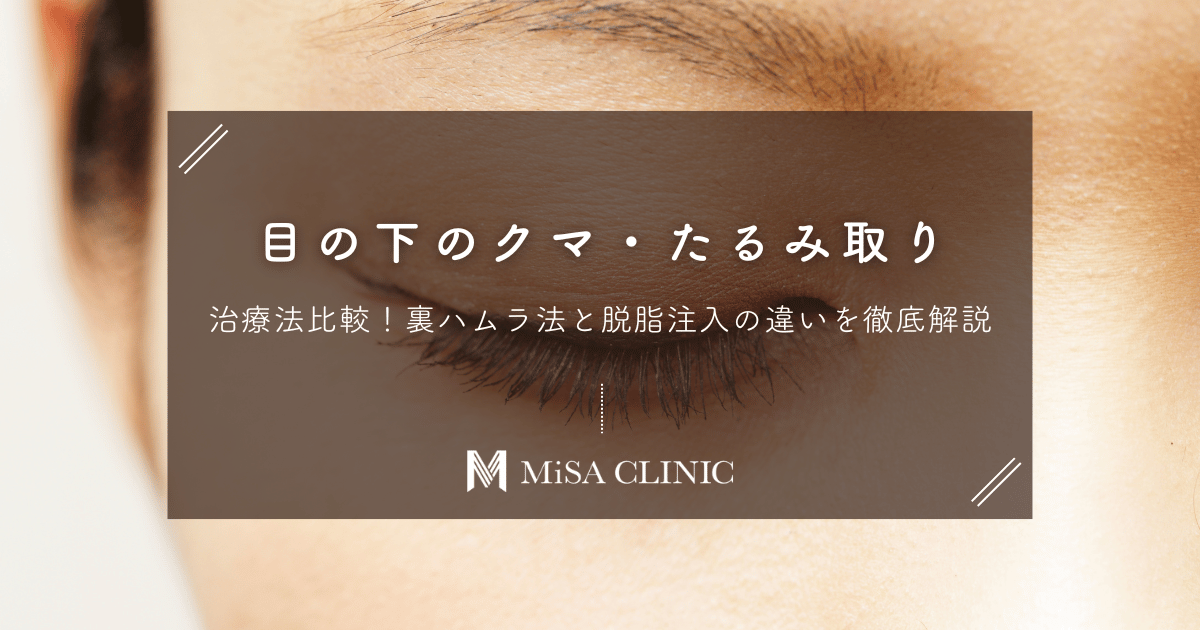 目の下のクマ・たるみ取りの治療法比較｜裏ハムラ法と脱脂注入の違いを徹底解説