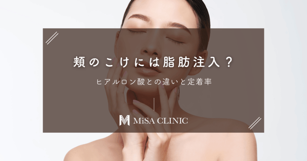 頬のこけには「脂肪注入」が向いている？ヒアルロン酸との違いと定着率