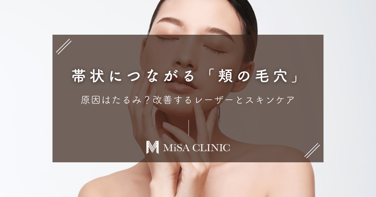 「頬の毛穴」が帯状に繋がる原因はたるみ？改善するレーザーとスキンケア
