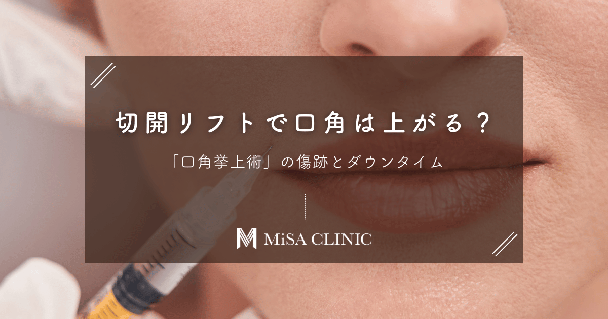 切開リフトで口角は上がる？「口角挙上術」の傷跡とダウンタイム
