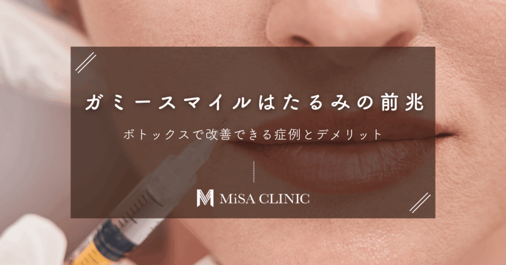 ガミースマイルはたるみの前兆？ボトックスで改善できる症例とデメリット