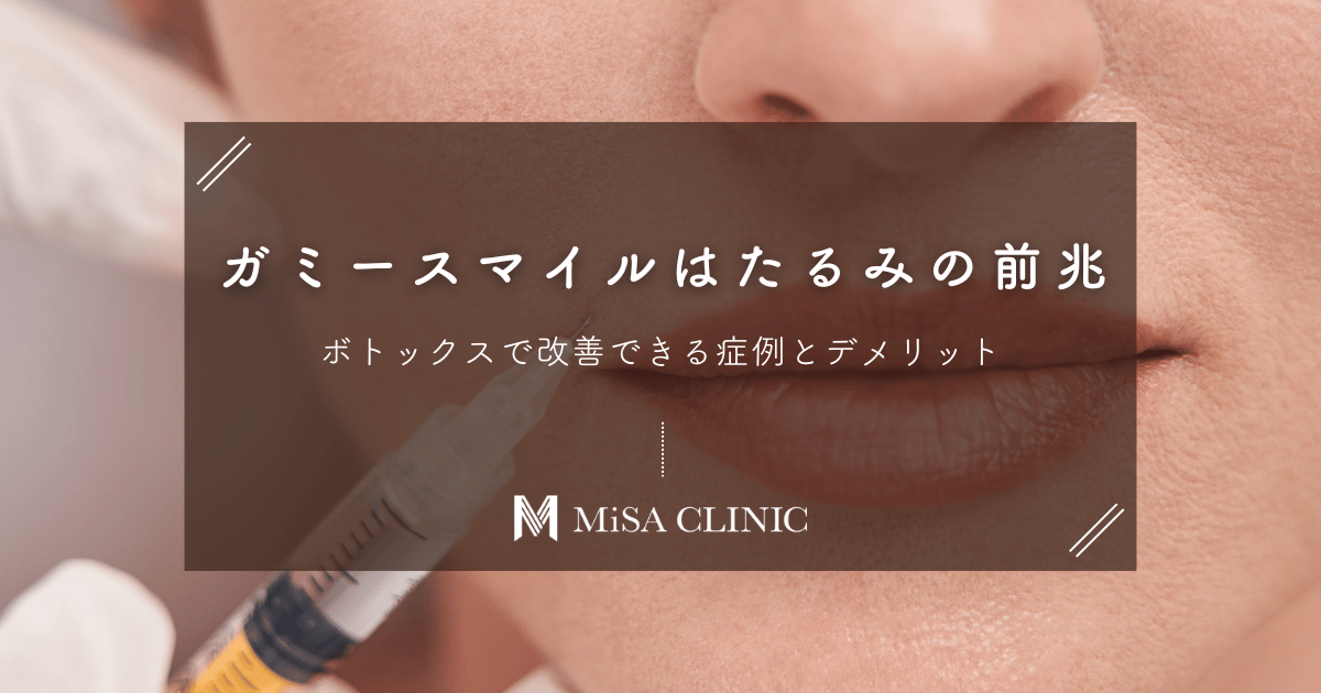 ガミースマイルはたるみの前兆？ボトックスで改善できる症例とデメリット