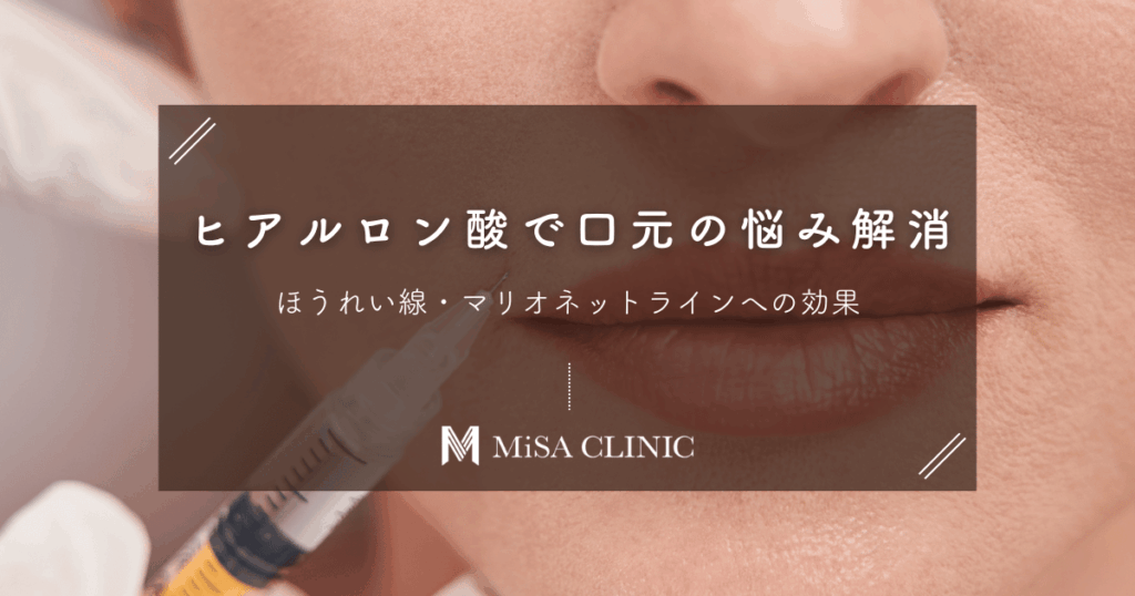 ヒアルロン酸で口元の悩み解消！ほうれい線・マリオネットラインへの効果