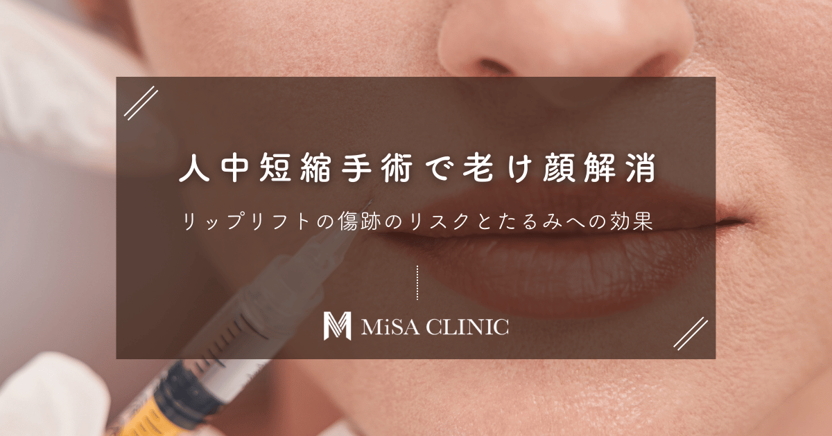 人中短縮手術（リップリフト）で老け顔解消｜傷跡のリスクとたるみへの効果
