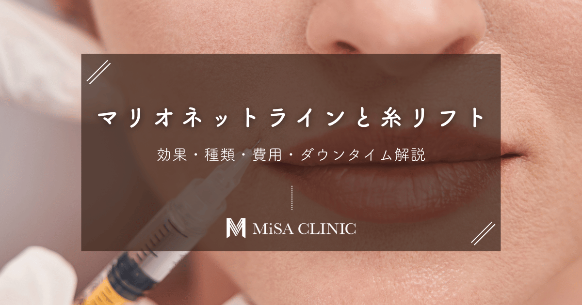 マリオネットラインは糸リフトで改善！効果・種類・費用・ダウンタイム解説