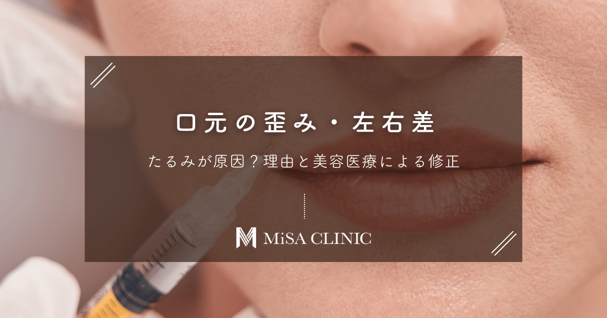口元の歪み・左右差はたるみが原因？片側だけ下がる理由と美容医療による修正