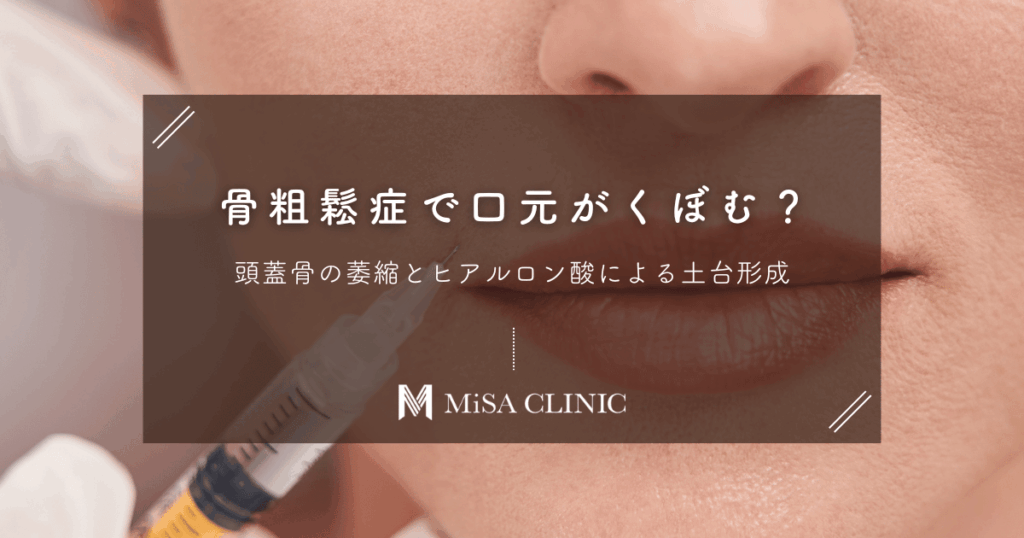 骨粗鬆症で口元がくぼむ？頭蓋骨の萎縮とヒアルロン酸による土台形成