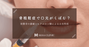 骨粗鬆症で口元がくぼむ？頭蓋骨の萎縮とヒアルロン酸による土台形成