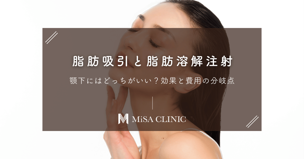 脂肪吸引と脂肪溶解注射、顎下にはどっちがいい?効果と費用の分岐点