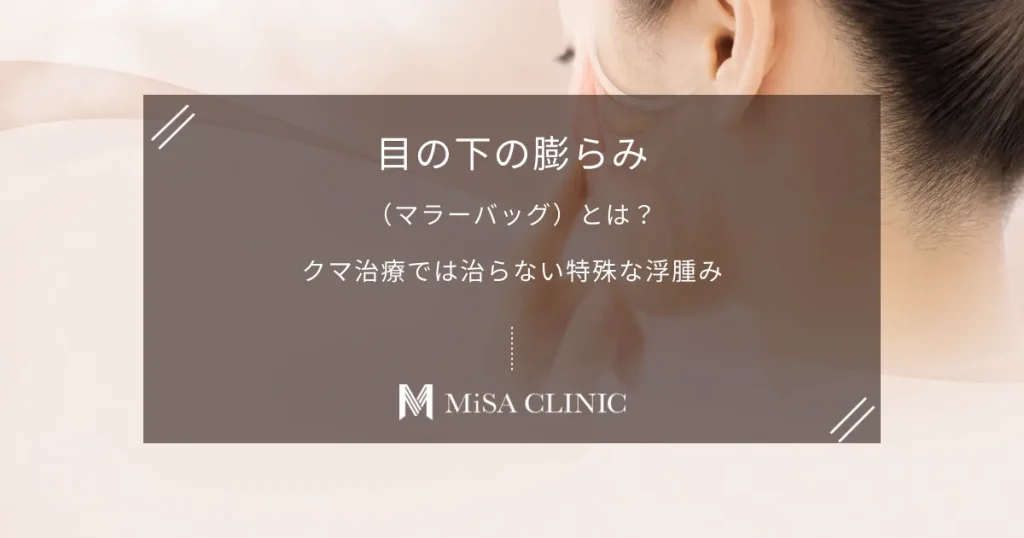 目の下の膨らみ（マラーバッグ）とは？クマ治療では治らない特殊な浮腫み