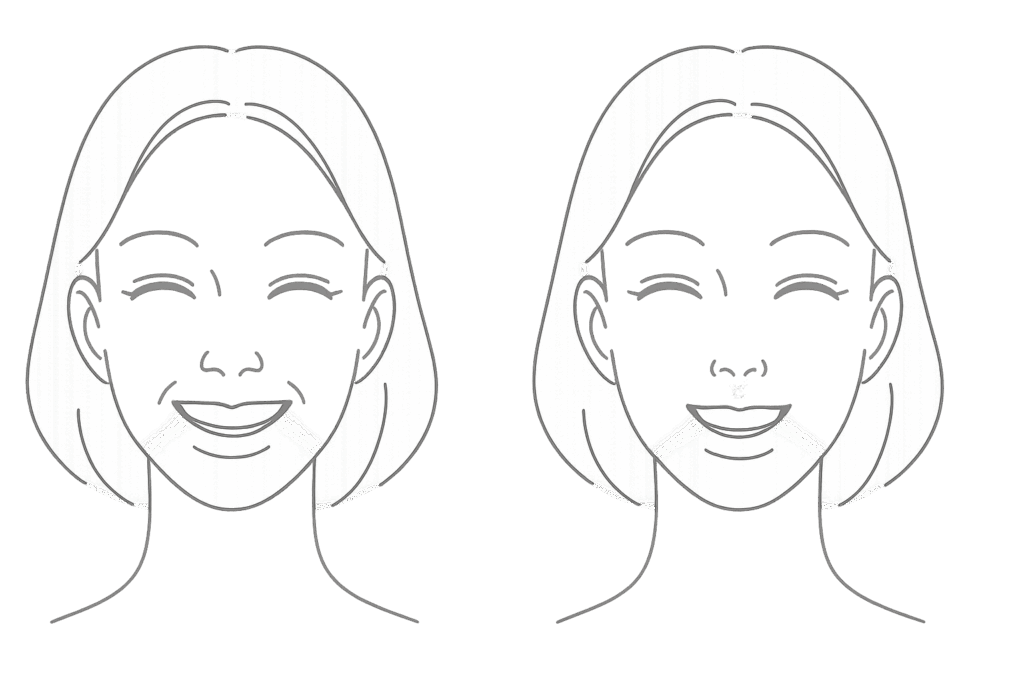 小鼻ボトックスで鼻の広がりを抑えすっきり見せるイラスト