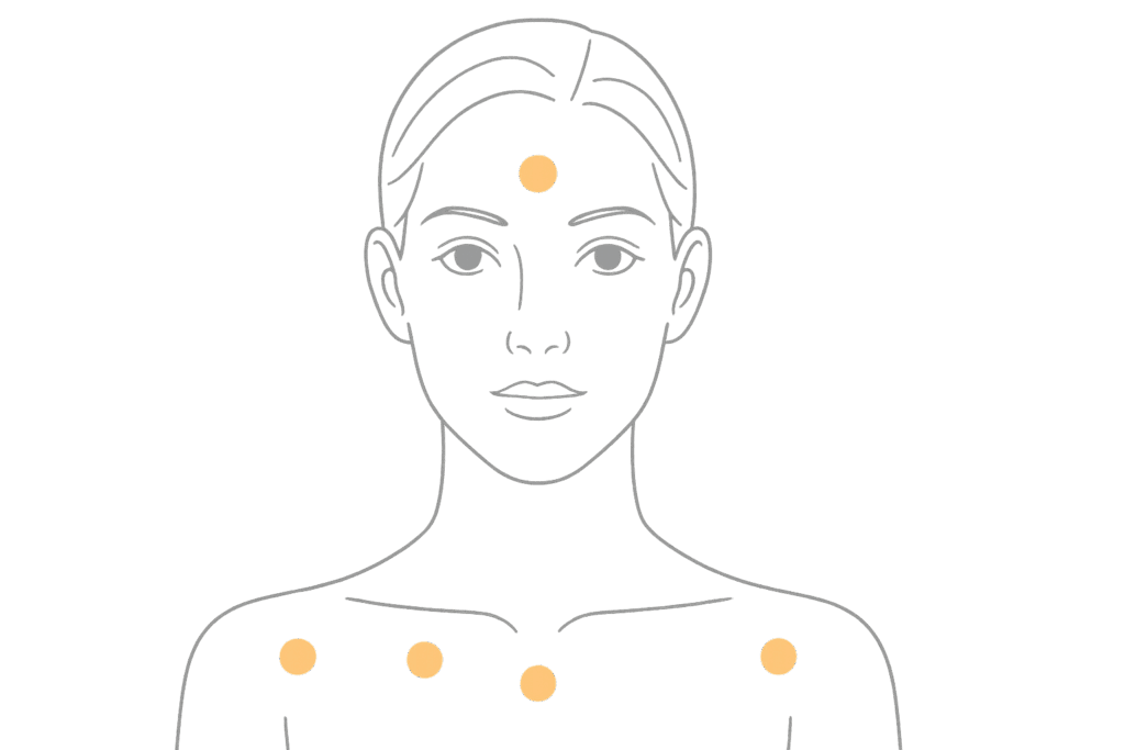 ボトックス注射の主な用途（部位別）を示す顔面イラスト