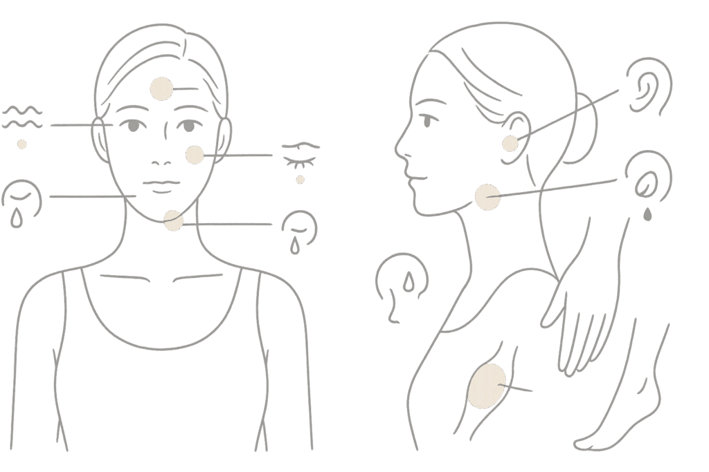 ボトックス注射の主要施術部位と期待できる効果マップ