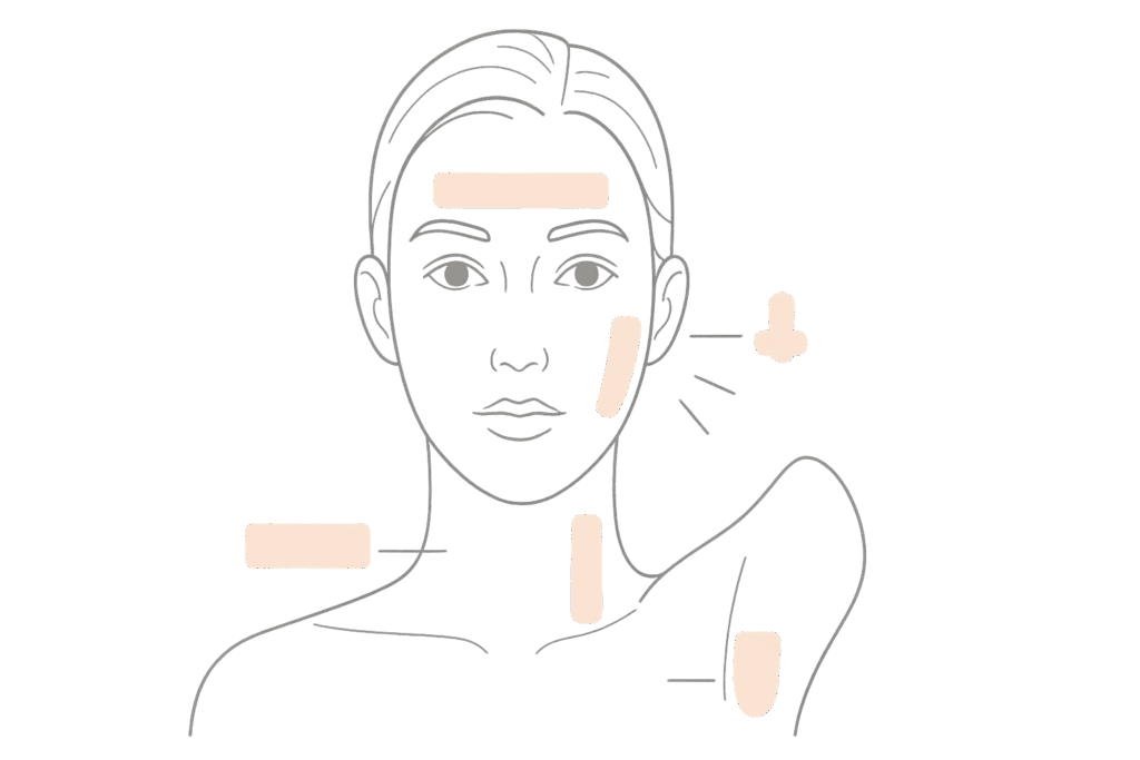ボトックス注射で改善できる代表的な悩み（シワ・小顔・多汗症）