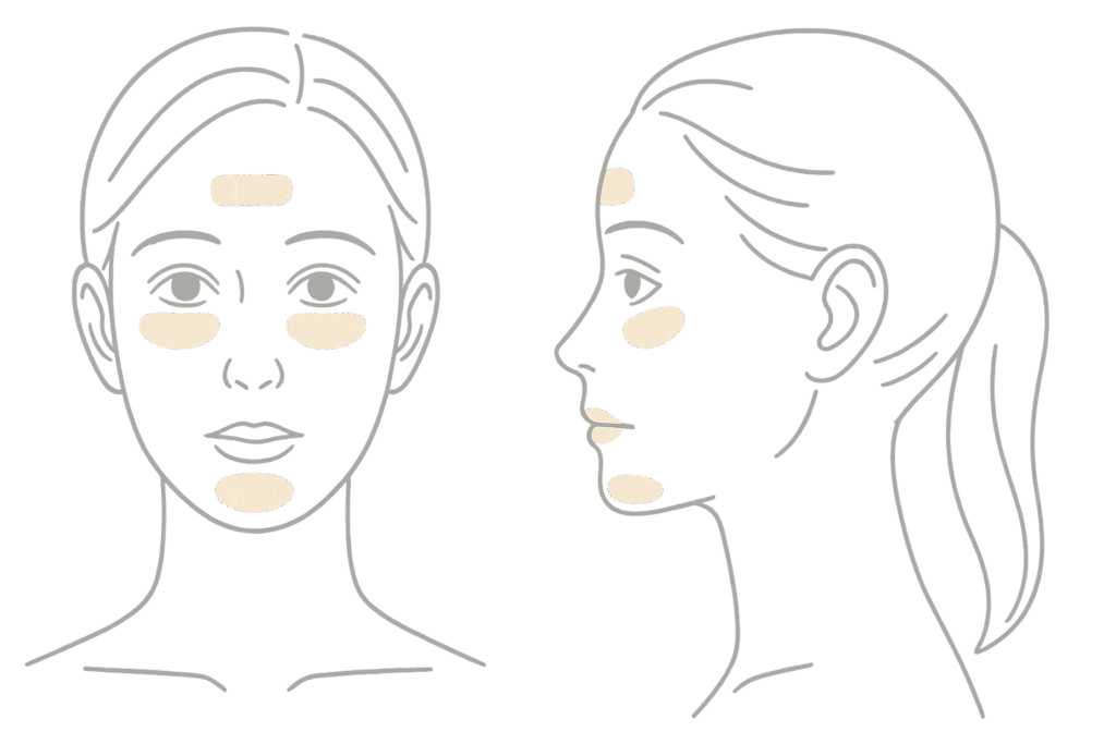 部位別のダウンタイムの違い