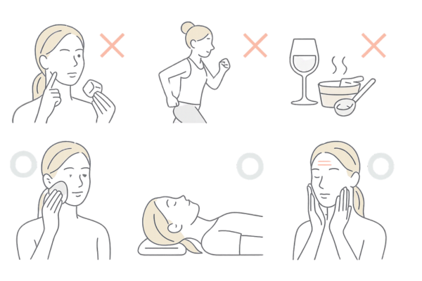 施術後の注意点：触らない・運動/長風呂/飲酒回避・横にならない・冷却