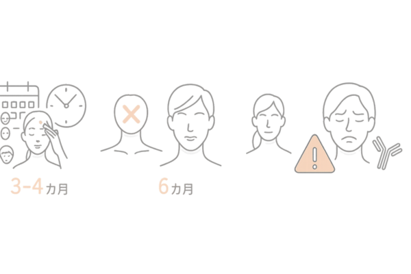 部位別の推奨施術間隔と頻回投与のリスク(耐性・不自然さ)