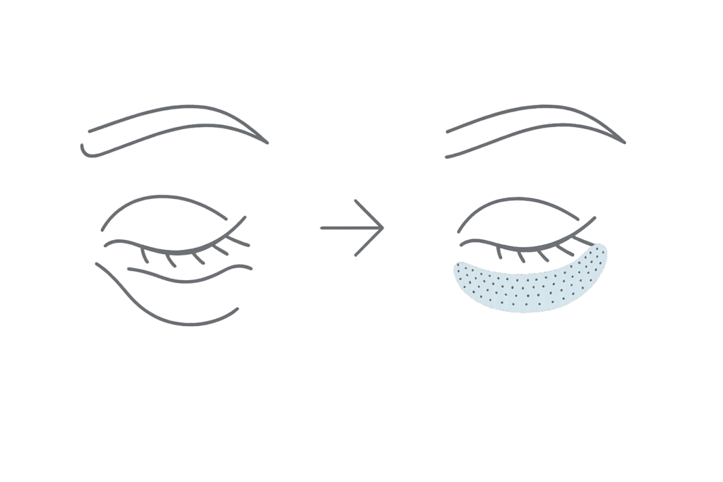 黒クマ・青クマに対するベビーコラーゲンの改善メカニズム