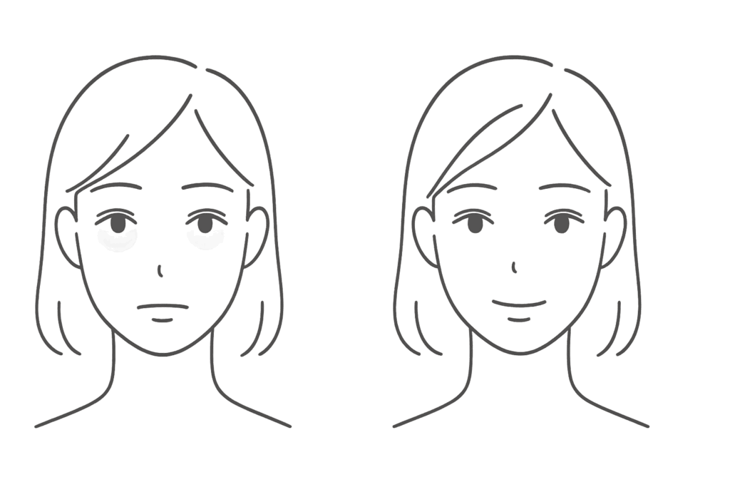 ベビーコラーゲン注入後の内出血の原因と経過図