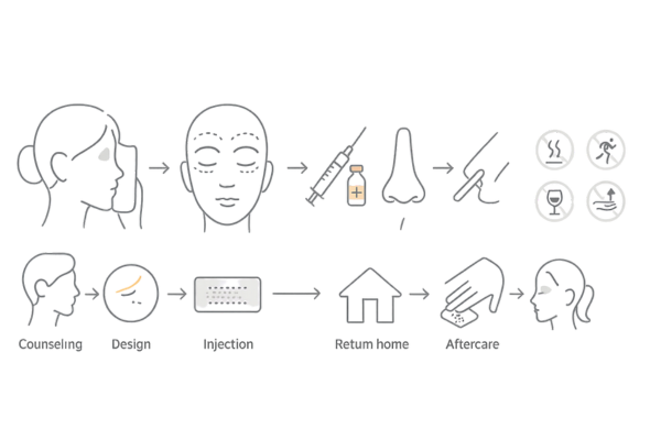 ヒアルロン酸注射の施術フローと術後注意(タイムライン)