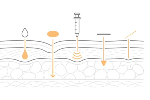 切らないクマ取り5施術の作用層と特徴(注入・照射・糸)概念図
