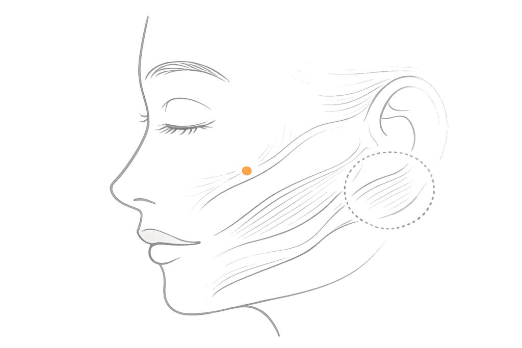 ボトックスの拡散と注入層の違い（意図しない筋への影響リスク）