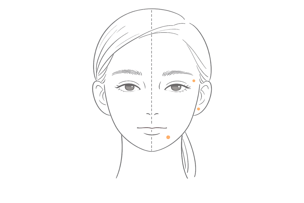 ボトックスで起こりうる左右差（眉・目元・口角のバランス例）