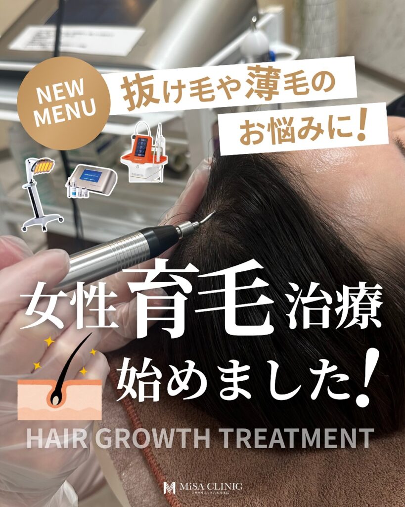 インスタグラム女性育毛