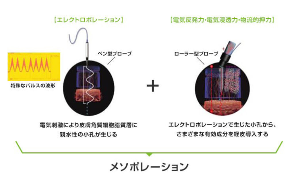 メソナJの仕組み