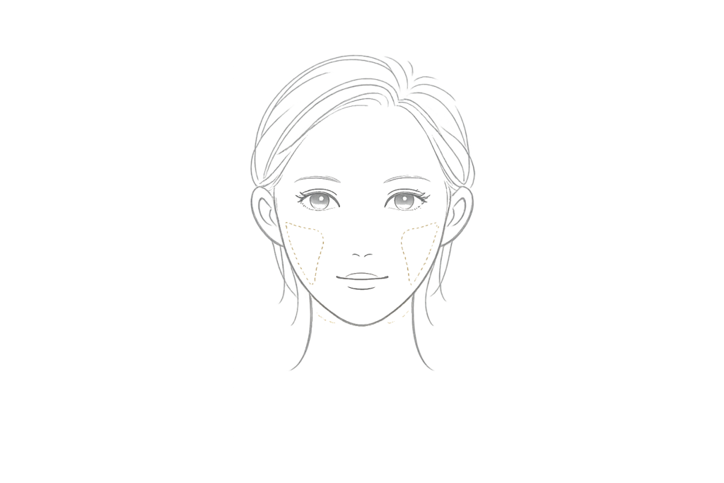 ジェンバー糸が向いている悩み（ほうれい線・マリオネット・フェイスライン）部位のイメージ