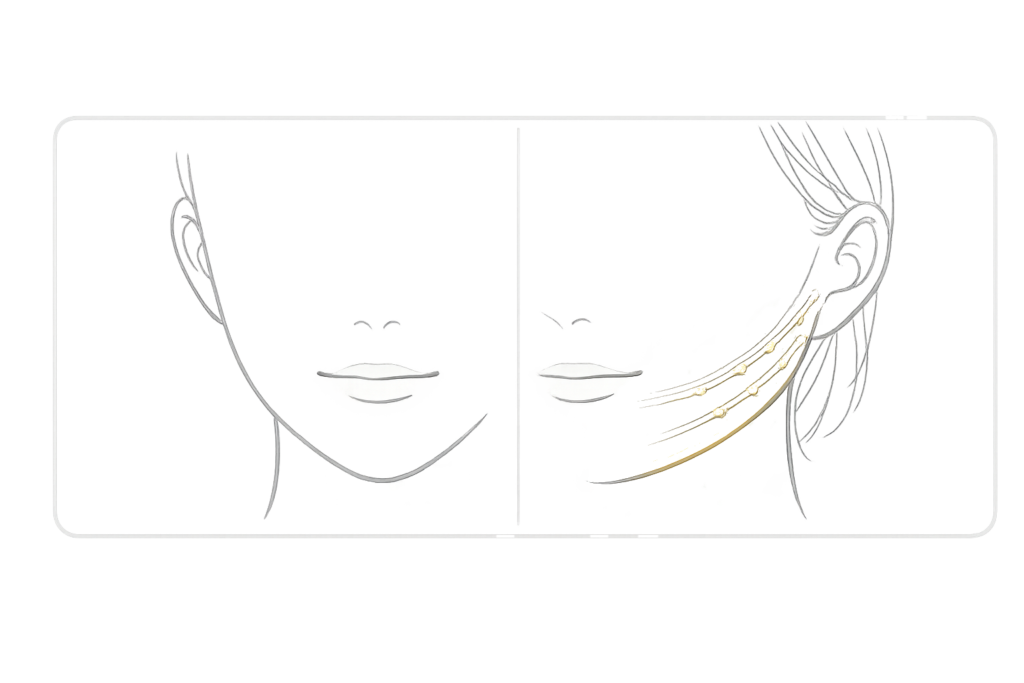 ヴィーナスリフトの自然な引き上げ（ふんわりリフト）のイメージ