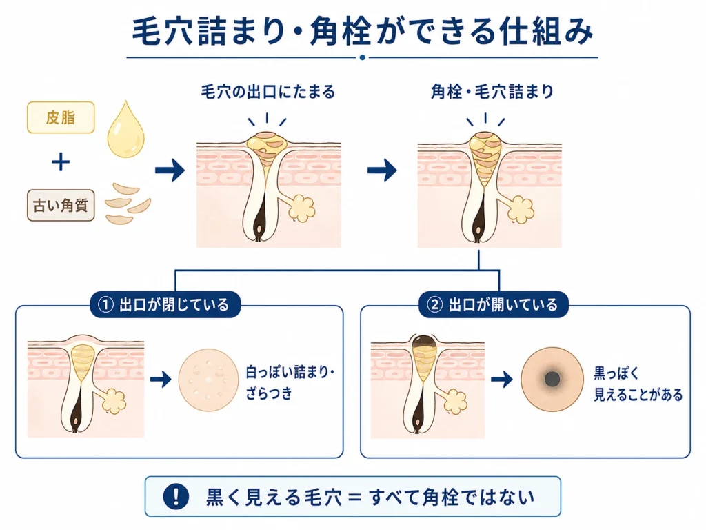 毛穴詰まり・角栓ができる仕組み