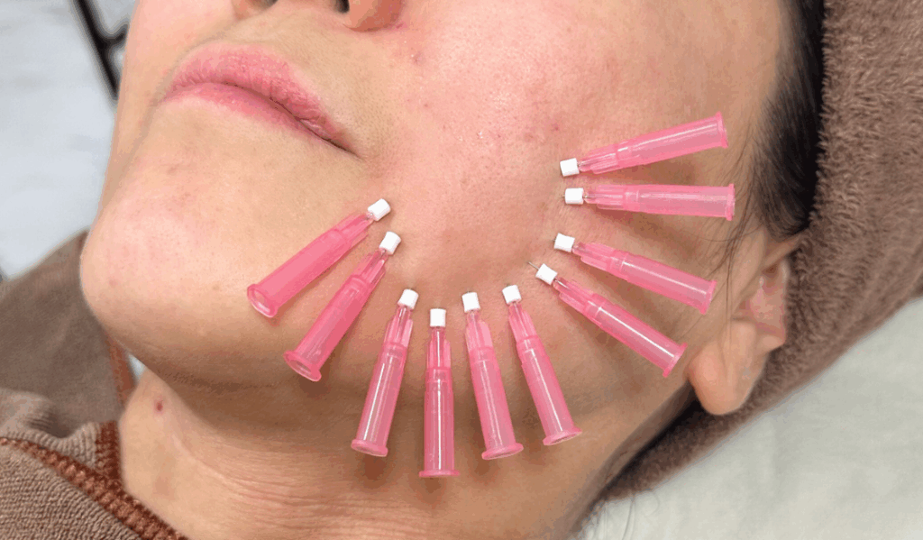 ショッピングリフト