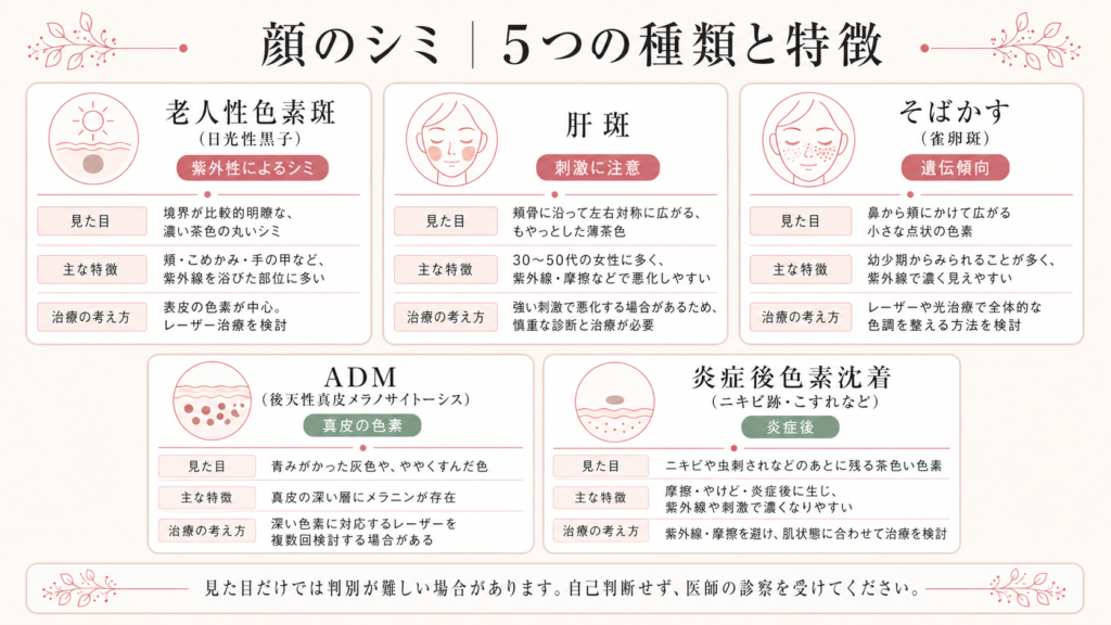 顔のシミ、5つの種類と特徴