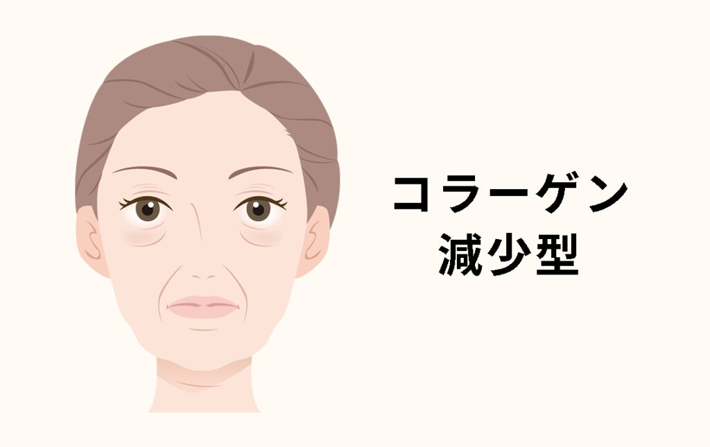 コラーゲン減少型