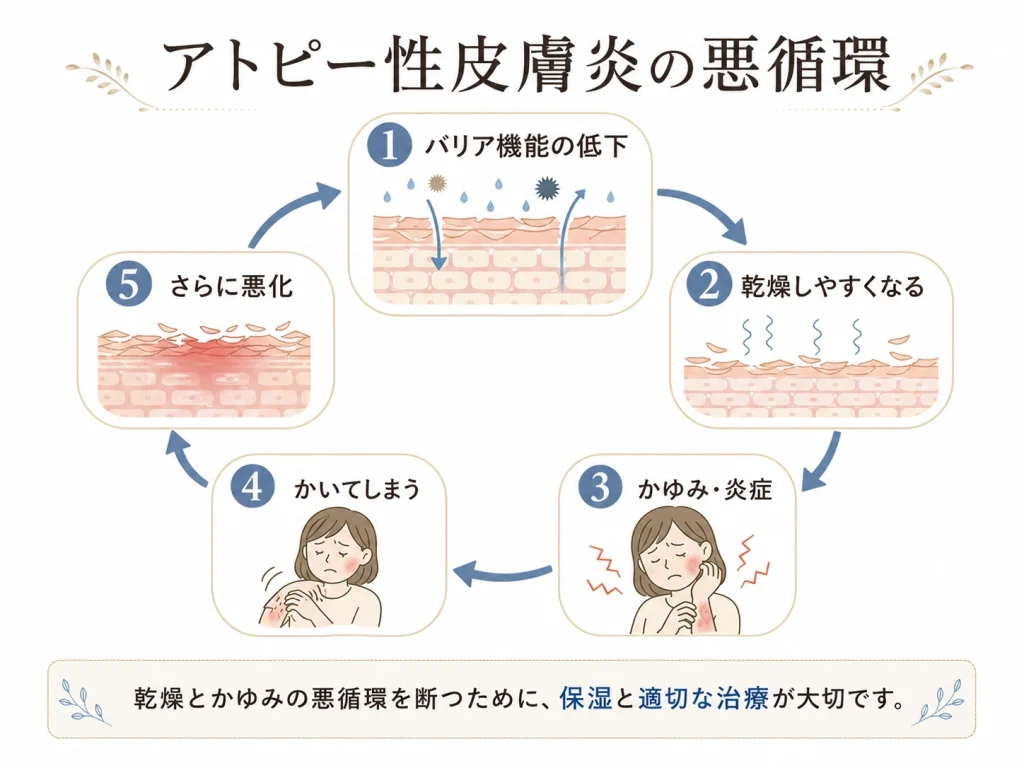 アトピー性皮膚炎の悪循環