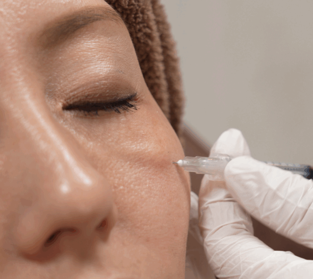 ベビーコラーゲン